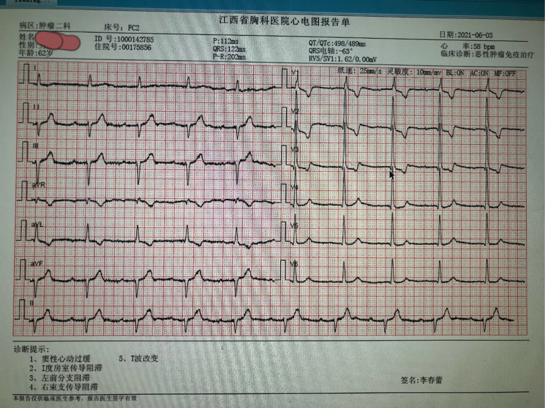 我院成功救治一例不典型免疫性心肌炎患者